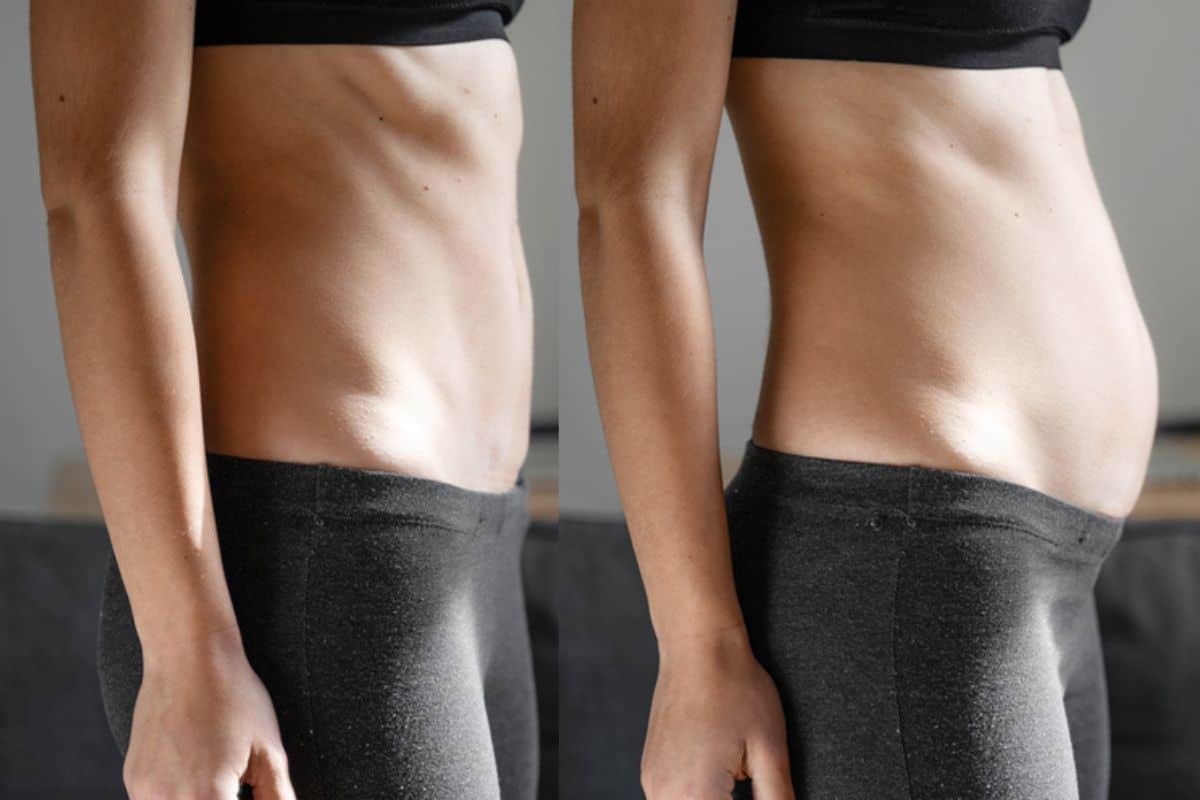 How long does diastasis recti take to improve Warrington?