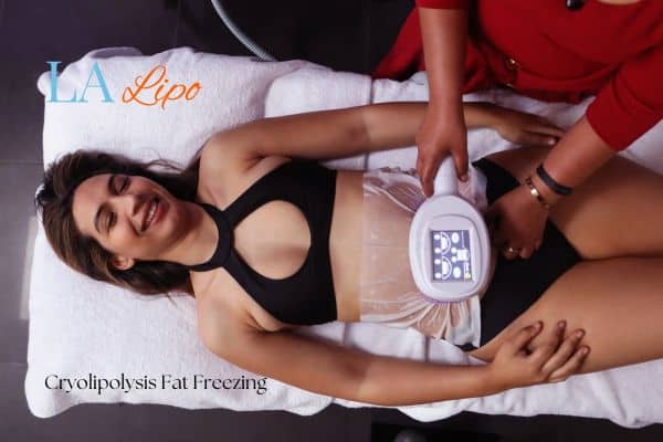 woman getting cryolipolysis Warrington