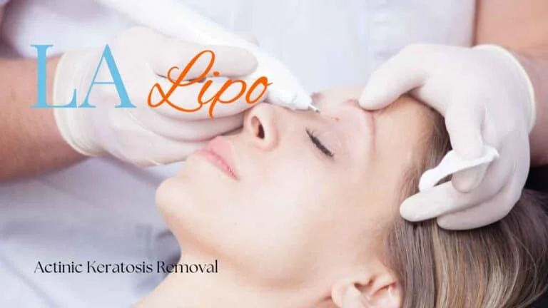 Woman receiving Actinic Keratosis Removal Treatment Warrington