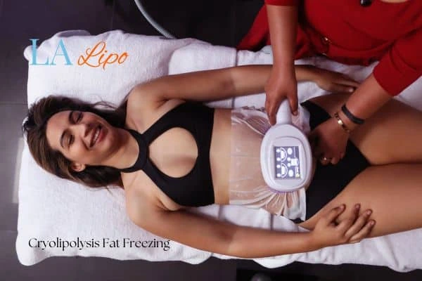woman getting cryolipolysis Warrington