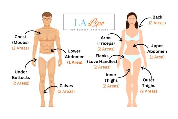 LA LIPO Cryolipolysis Areas Warrington