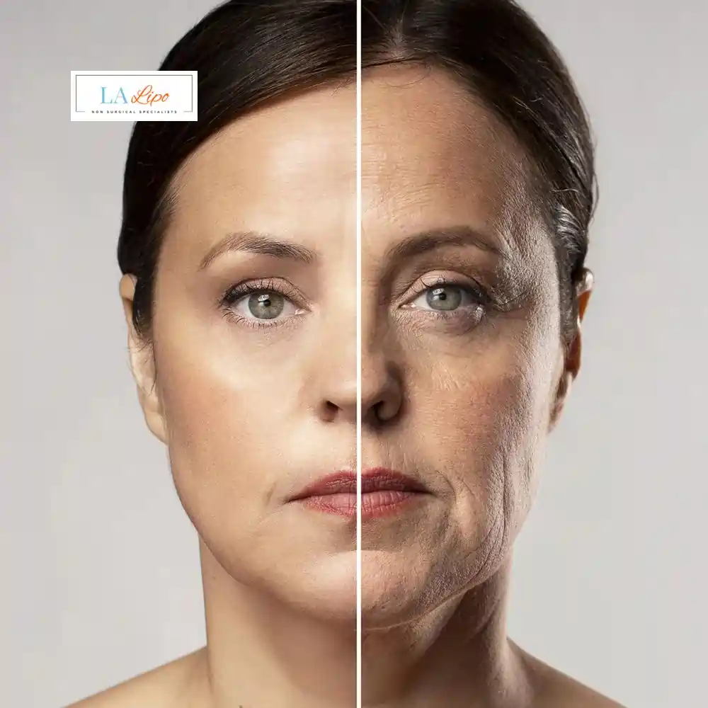 How Can You Tell If Non-Surgical Skin Tightening Is Right for You Warrington?