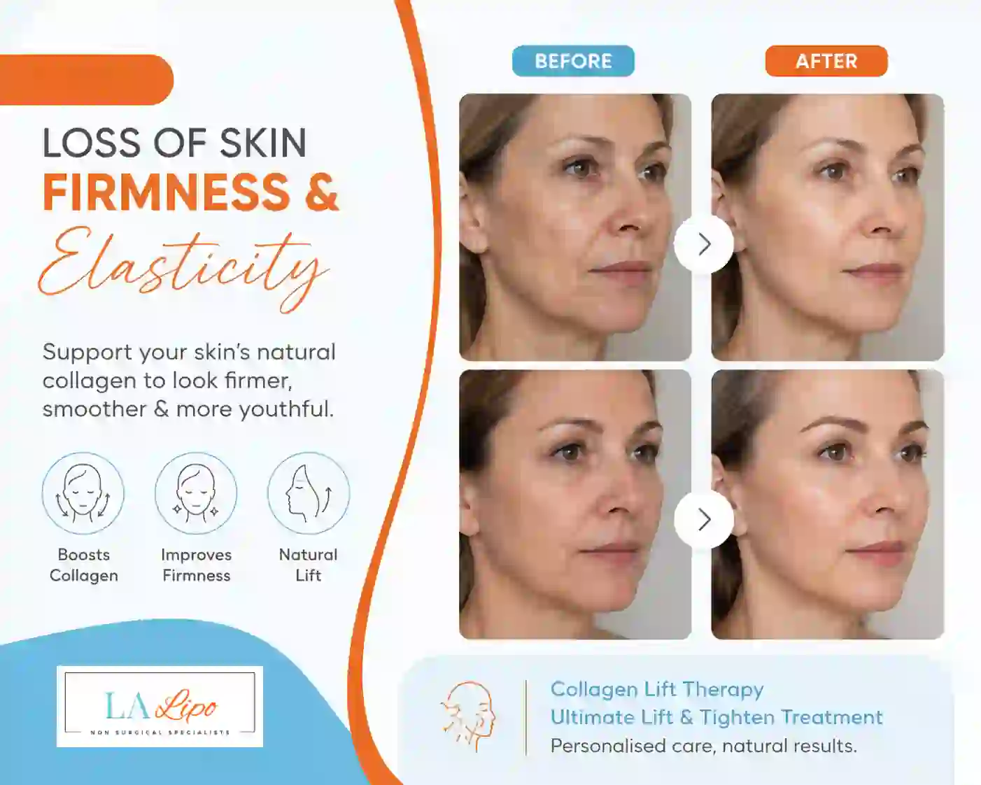 Sign #7: Loss of Skin Firmness and Elasticity Warrington